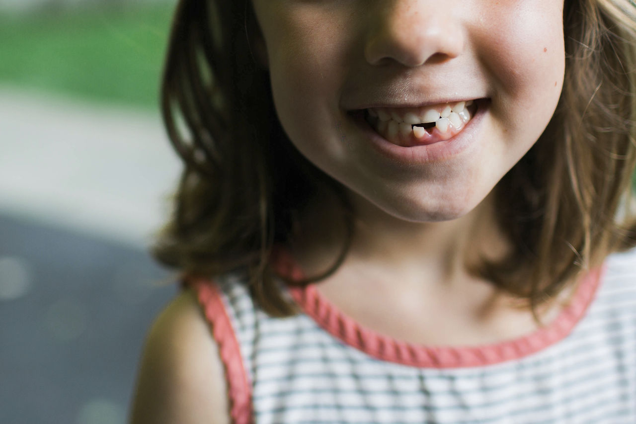 ¿Qué Hacer Ante Un Traumatismo Dental En Niños? - Muy Saludable De Bupa